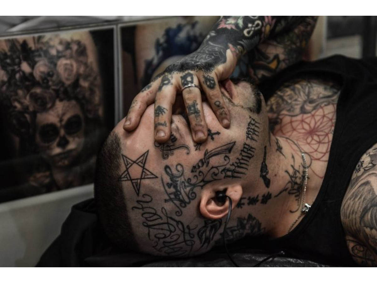 Первичная анестезия